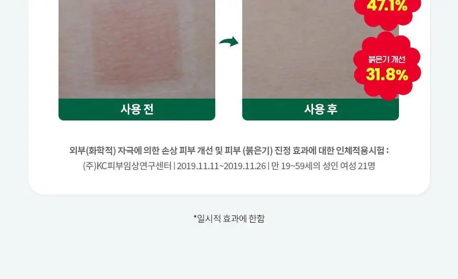 [진정수분/대용량] 닥터지 레드블레미쉬 클리어 수딩 액티브 에센스 80ml 상세페이지 12